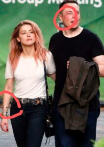 PHOTO-Close-Up-Of-Amber-Heards-Bruise-On-Her-Arm-And-Elon-Musks-Swollen-And-Bruised-Face-Raises-A-Lot-Of-Questions-On-What-Happened-212x300